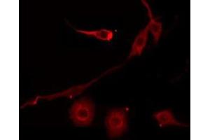 ABIN6275556 staining Hela by IF/ICC. (SERPINB7 anticorps  (Internal Region))