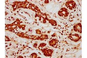 anti-Protein Phosphatase 2, Regulatory Subunit A, beta (PPP2R1B) (AA 402-601), (Regulatory Subunit A) antibody