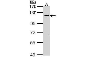 WB Image Sample (30 ug of whole cell lysate) A: Hela 7.