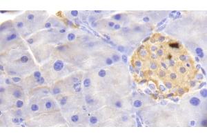 Detection of HBb in Mouse Pancreas Tissue using Polyclonal Antibody to Hemoglobin Beta (HBb)