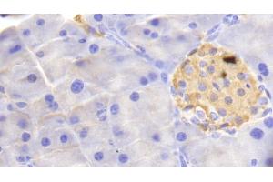 Detection of HBb in Mouse Pancreas Tissue using Polyclonal Antibody to Hemoglobin Beta (HBb) (Hemoglobin Subunit beta anticorps  (AA 1-147))