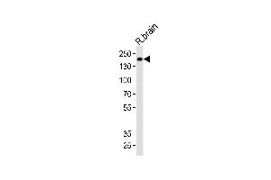 Western blot analysis of lysate from rat brain tissue, using Mouse Insrr Antibody (C-term) (ABIN6243236 and ABIN6577628). (INSRR anticorps  (C-Term))