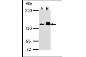 Sample (30 µg of whole cell lysate). (CARD11 anticorps)