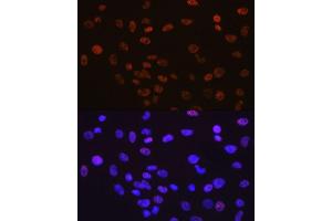 Immunofluorescence analysis of C6 cells using YY1 antibody (ABIN7271428).