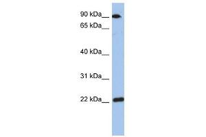 TMED10 antibody used at 1 ug/ml to detect target protein. (TMED10 anticorps)
