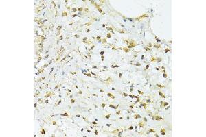 Immunohistochemistry of paraffin-embedded human vermiform appendix using TRIM15 antibody (ABIN5999102) at dilution of 1/100 (40x lens). (TRIM15 anticorps)