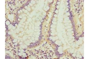 Immunohistochemistry of paraffin-embedded human small intestine tissue using ABIN7158182 at dilution of 1:100