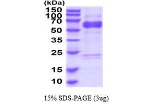 SDS-PAGE (SDS) image for ADAM Metallopeptidase Domain 10 (ADAM10) (AA 214-672) protein (His tag) (ABIN6387898)