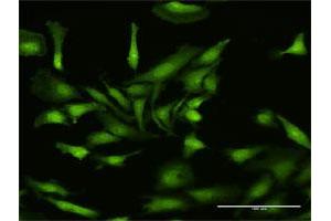 Immunofluorescence of purified MaxPab antibody to NLRP2 on HeLa cell.