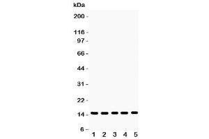 Western blot testing of Profilin-1 antibody and Lane 1:  rat testis (PFN1 anticorps  (C-Term))