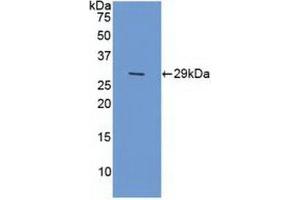 Detection of Recombinant XPG, Human using Polyclonal Antibody to Xeroderma Pigmentosum, Complementation Group G (XPG) (ERCC5 anticorps  (AA 778-986))