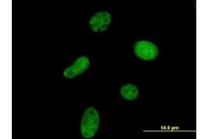 Immunofluorescence of purified MaxPab antibody to UCKL1 on HeLa cell. (UCKL1 anticorps  (AA 1-419))