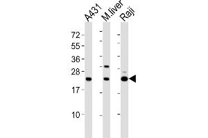 All lanes : Anti-PSMB9 Antibody (C-term) at 1:2000 dilution Lane 1: A431 whole cell lysates Lane 2: mouse liver lysates Lane 3: Raji whole cell lysates Lysates/proteins at 20 μg per lane.
