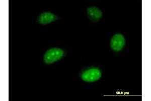 Immunofluorescence of monoclonal antibody to ISG20 on HeLa cell. (ISG20 anticorps  (AA 1-181))