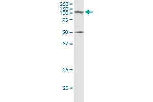 SAGE1 monoclonal antibody (M02), clone 5C1. (SAGE1 anticorps  (AA 357-455))