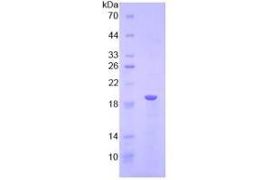 SDS-PAGE analysis of Human LPCAT3 Protein. (LPCAT3 Protéine)