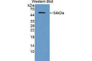 Detection of Recombinant COL5a2, Human using Polyclonal Antibody to Collagen Type V Alpha 2 (COL5a2) (COL5A2 anticorps  (AA 82-308))