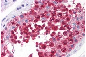 Human Testis: Formalin-Fixed, Paraffin-Embedded (FFPE)