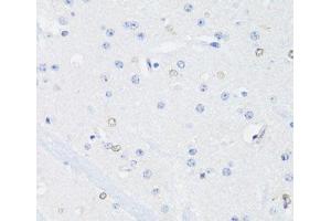 Immunohistochemistry of paraffin-embedded Mouse brain using SS18L1 Polyclonal Antibody at dilution of 1:100 (40x lens). (SS18L1 anticorps)