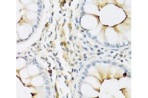 Immunohistochemistry of paraffin-embedded Human colon using RNASE3 Polyclonal Antibody at dilution of 1:100 (40x lens). (RNASE3 anticorps)