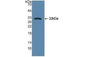 Detection of Recombinant SPHK1, Human using Polyclonal Antibody to Sphingosine Kinase 1 (SPHK1) (SPHK1 anticorps  (AA 148-398))