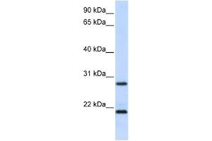 MUC1 antibody used at 1 ug/ml to detect target protein.