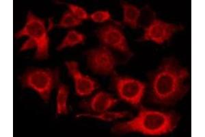 ABIN6276000 staining Hela by IF/ICC. (GPR101 anticorps  (Internal Region))