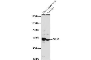 Western blot analysis of extracts of various cell lines, using GLR antibody (ABIN7267462) at 1:1000 dilution. (GLRa2 anticorps  (AA 350-420))