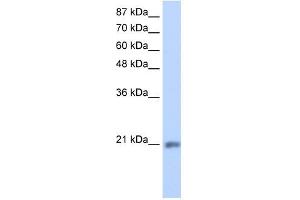 MIF4GD antibody used at 1. (MIF4GD anticorps  (C-Term))