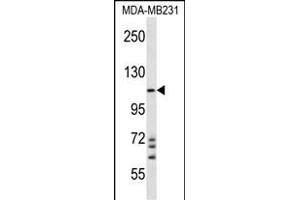 NLRC4 Antibody (N-term) (ABIN657230 and ABIN2846332) western blot analysis in MDA-M cell line lysates (35 μg/lane). (NLRC4 anticorps  (N-Term))