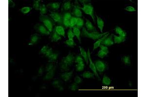 Immunofluorescence of monoclonal antibody to RELA on HeLa cell.