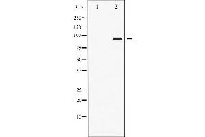 Western blot analysis of STAT6 phosphorylation expression in IL-4 treated HeLa whole cell lysates,The lane on the left is treated with the antigen-specific peptide.