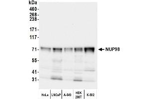 Western Blotting (WB) image for anti-Nucleoporin 98kDa (NUP98) (AA 600-650) antibody (ABIN7451911)