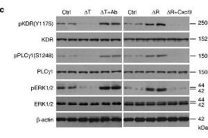 Cxcl9 is responsible for vascular phenotypes in mutant mouse bone.