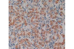 Used in DAB staining on fromalin fixed paraffin- embedded stomach tissue