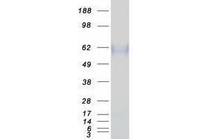 Validation with Western Blot