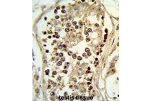 anti-Abhydrolase Domain Containing 12 (ABHD12) antibody