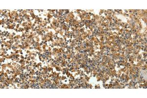 Immunohistochemistry of paraffin-embedded Human tonsil tissue using SFTPD Polyclonal Antibody at dilution 1:30 (SFTPD anticorps)