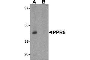 Western blot analysis of PRR5 in SK-N-SH cell lysate with PRR5 antibody at 1 μg/ml in (A) the absence and (B) the presence of blocking peptide (PRR5 anticorps  (C-Term))