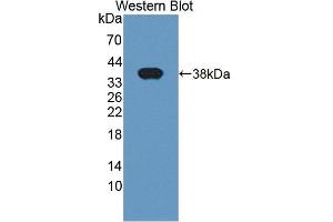Western blot analysis of the recombinant protein. (LASP1 anticorps  (AA 1-261))