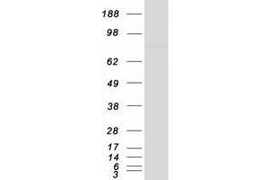 Validation with Western Blot