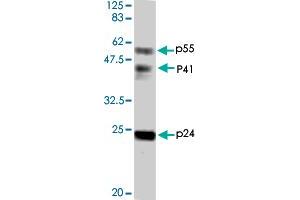 Detection of HIV-1 p24 and precursor proteins p55 and p41 by Western blotting using the HIV-1 Gag p24 polyclonal antibody  . (HIV-1 p24 anticorps)