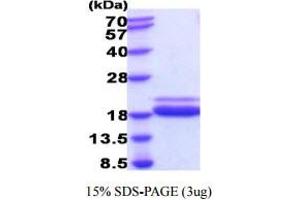 SDS-PAGE (SDS) image for Tumor Necrosis Factor alpha (TNF alpha) (AA 80-235) (Active) protein (His tag) (ABIN6387644)