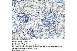 Rabbit Anti-DDX17 Antibody  Paraffin Embedded Tissue: Human Kidney Cellular Data: Epithelial cells of renal tubule Antibody Concentration: 4. (DDX17 anticorps  (N-Term))