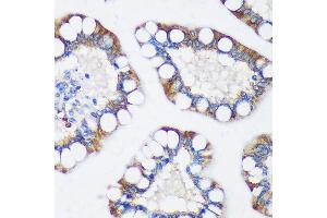 Immunohistochemistry of paraffin-embedded Human colon using TRIM62 Rabbit pAb (ABIN7270996) at dilution of 1:100 (40x lens).