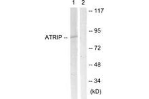 Western blot analysis of extracts from NIH-3T3 cells, using ATRIP (Ab-68/72) Antibody. (ATRIP anticorps  (AA 34-83))