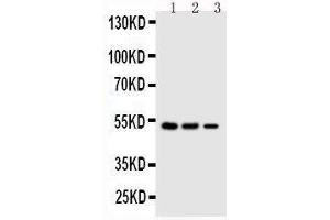 Anti-Kallistatin antibody, Western blotting Lane 1: SMMC Cell Lysate Lane 2: COLO320 Cell Lysate Lane 3: JURKAT Cell Lysate (SERPINA4 anticorps  (C-Term))