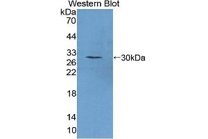 Detection of Recombinant PTTG1, Mouse using Polyclonal Antibody to Pituitary Tumor Transforming 1 (PTTG1) (PTTG1 anticorps  (AA 2-199))