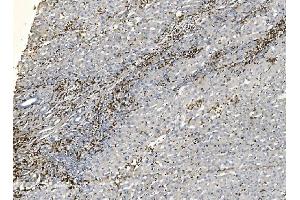 IHC analysis of Coronin 1a/TACO/CORO1A using anti-Coronin 1a/TACO/CORO1A antibody (ABIN7600292).