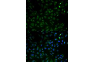 Immunofluorescence analysis of HeLa cells using VDAC1 antibody. (VDAC1 anticorps)